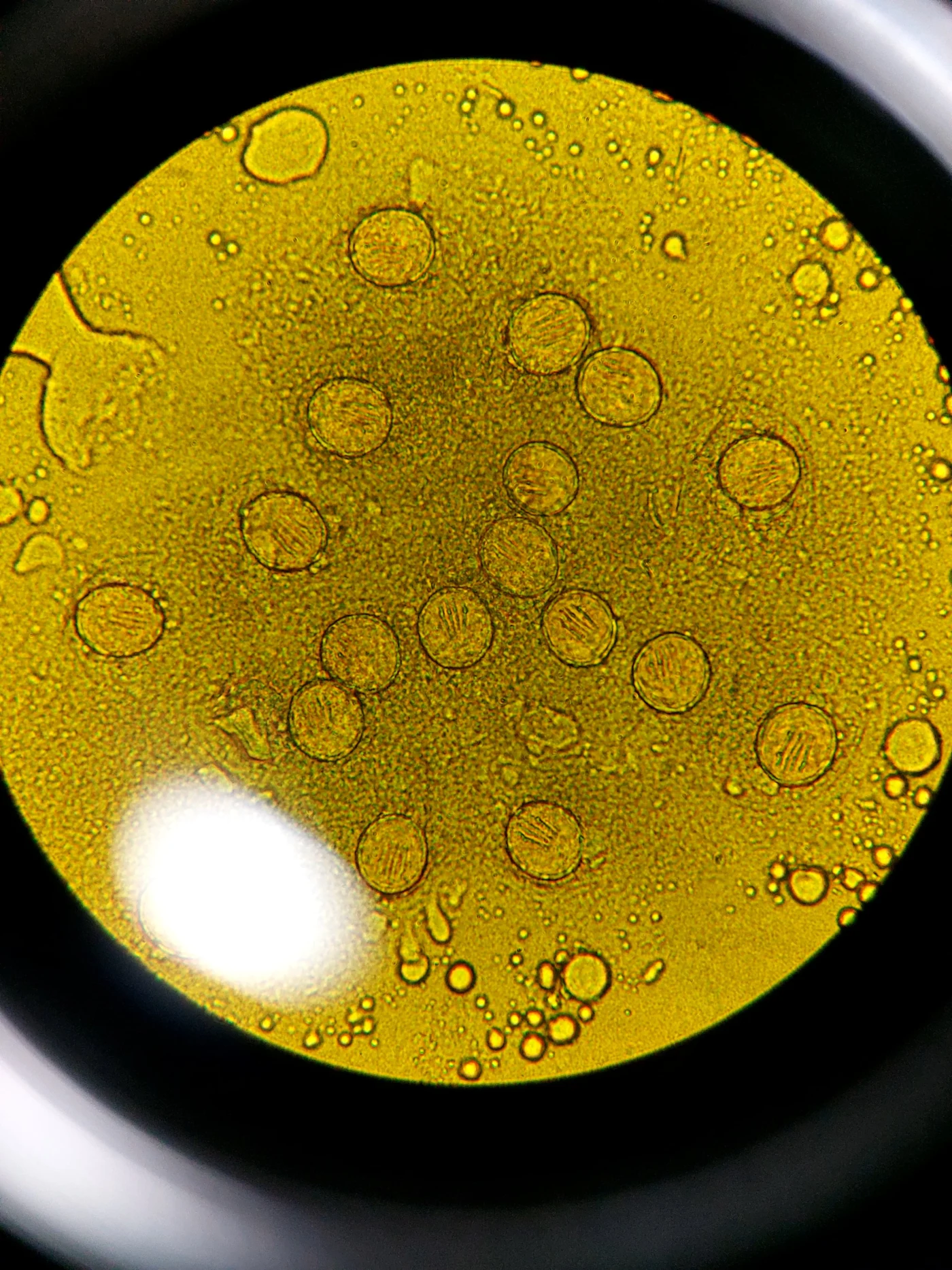 Estudio coproparasitoscópico